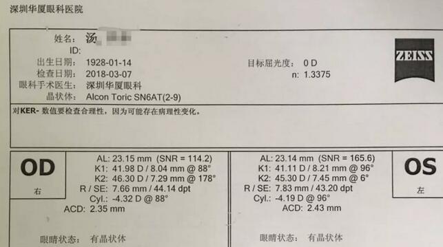 3月12日下午，已经90高龄的离休东江纵队老兵汤爷爷，在深圳8868体育(中国)官方网站 - 登录入口检查之后，白内障专科邢宝刚主任为其实施左眼白内障超声乳化摘除，联合散光人工晶体植入术。2.jpg