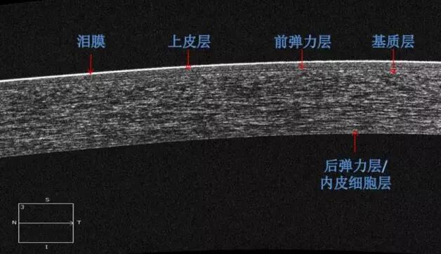 8868体育官网入口课堂：后节频域OCT前节模块的运用2.jpg