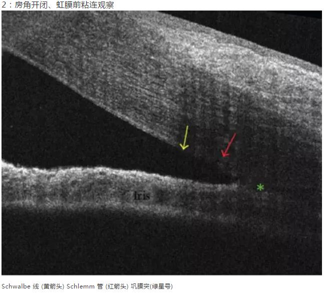 8868体育官网入口课堂：后节频域OCT前节模块的运用12.jpg