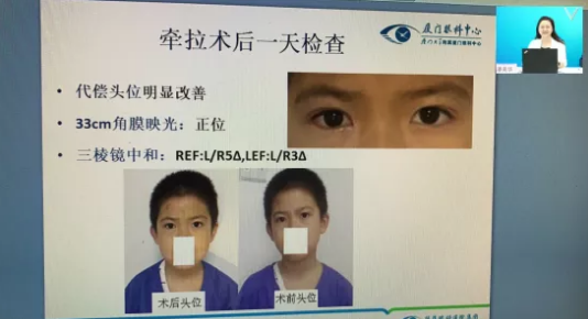 高峰论道·云端荟萃 ▏万人同步在线，30余名大咖云集“第六届8868体育官网入口论坛斜视与小儿眼科新技术学习班暨小儿、眼视光分论坛”7.png